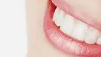 Novità - Scanner intraorale in studio